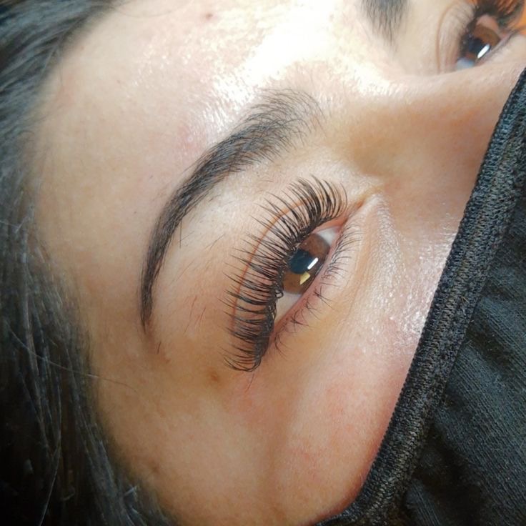 Extensiones